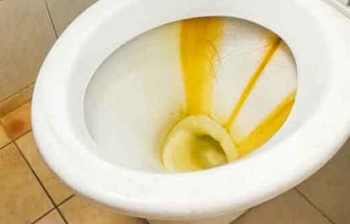 yellow stain bowl toilet