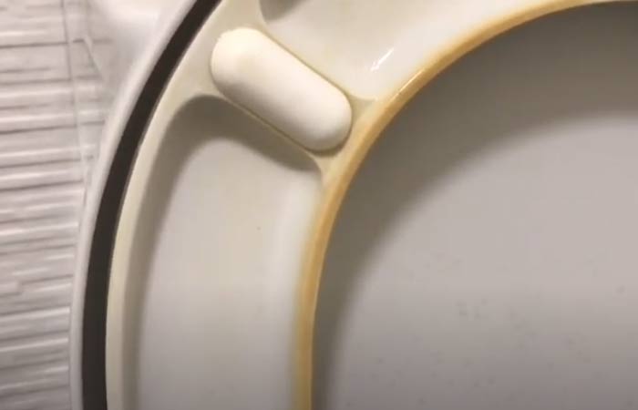 Yellow stains on toilet seat